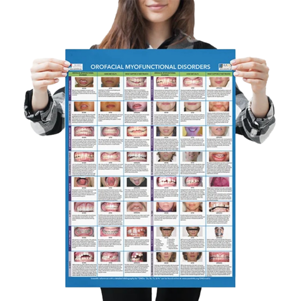 Orofacial Myofunctional Disorder (OMD) Matrix Poster