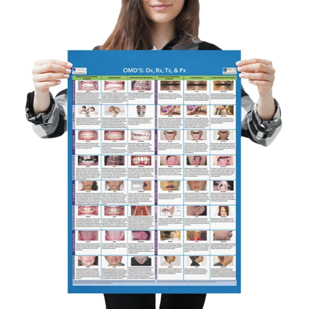Orofacial Myofunctional Disorder (OMD) Matrix Poster